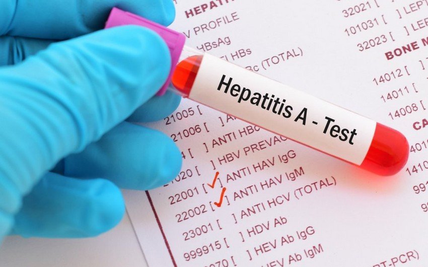 Nazirlik rəsmisi: "Hepatit A xroniki qaraciyər xəstəliyinə səbəb olmur"